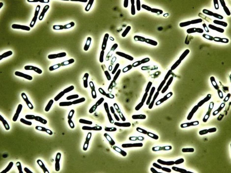 Окраска спор бактерий. Палочка цереус (Bacillus Cereus). Бактерии Bacillus subtilis. Сенная палочка микроскопия. Bacillus Cereus патогенность.