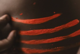still from Sanex ad featuring  red scratch marks on black skin