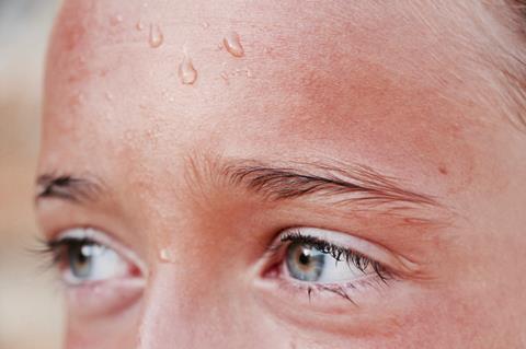 Sweaty woman's forehead
